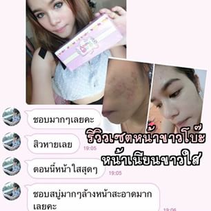 เซ็ตหน้าขาว(amma white set)