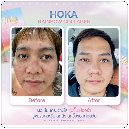 คอลลาเจนสายรุ้ง HOKA Random Rainbow Collagen คอลลาเจน 7 สี (1แถม1 ส่งฟรี)