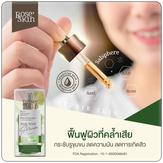 เซรั่มลดสิว โรเซ่สกิน Rose' Skin Anti Acne Serum