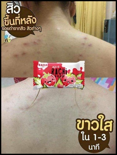 สบู่ราชิ Rachi Soap By Rada