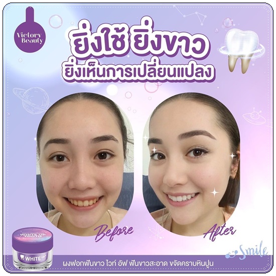 ผงฟอกฟันขาว ไวท์ อัพ Teeth Whitening White Up Tooth