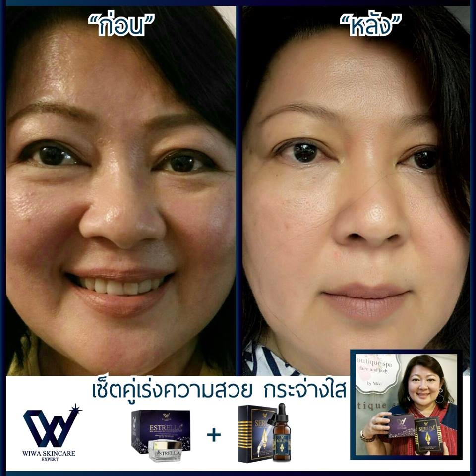 เอสเทรลล่า หน้าสวย กระจ่างใส ไร้จุดด่างดำ (Estrella Whitening and Anti-aging Moisturizer by Wiwa Skincare Expert)