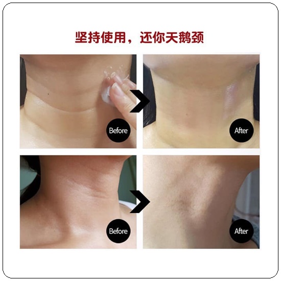 เมดิพีล ครีมทาคอ MEDI-PEEL Naite Thread Neck Cream