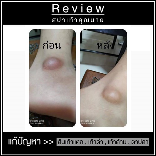 สปาเท้าคุณนาย สูตรใหม่