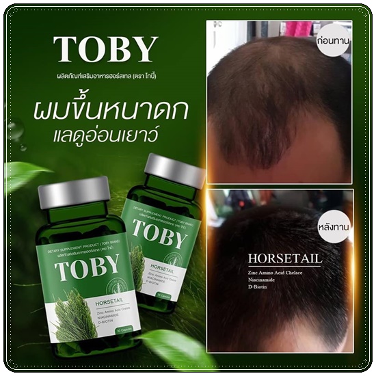 วิตามินลดผมร่วง เร่งผมยาว โทบี้ TOBY Horsetail