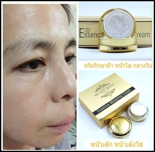 ครีม เอสเซนต์ เมลาสมา Essence Melasma Cream by Secret White Cream