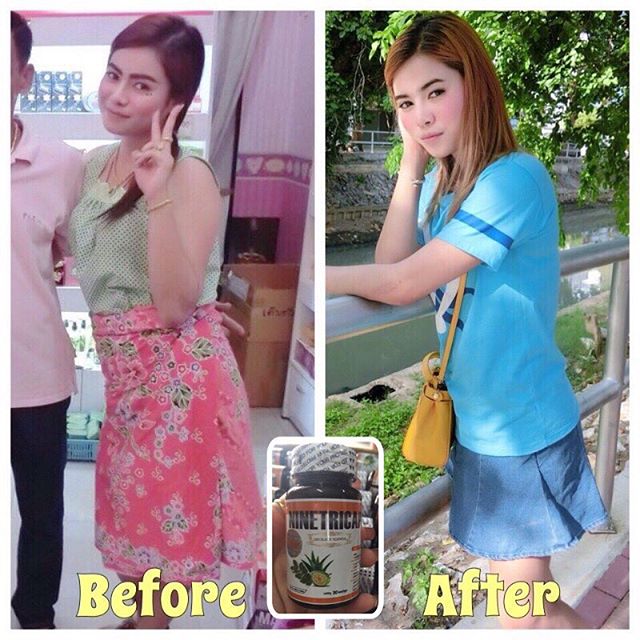 ไนท์ตริแคป สมุนไพรลดน้ำหนัก (Ninetricaps)