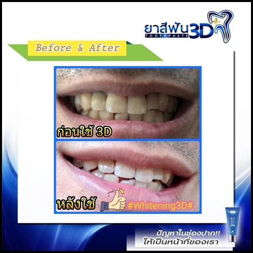 ยาสีฟัน 3D Plus Toothpaste เนื้อเจลนาโน