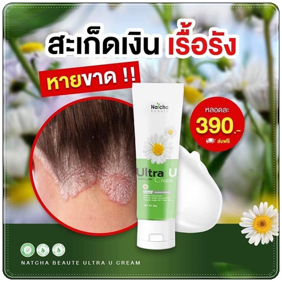 อัลตร้า ยู ครีม Ultra U Cream Natcha ลดอาการคัน กลากเกลื้อน