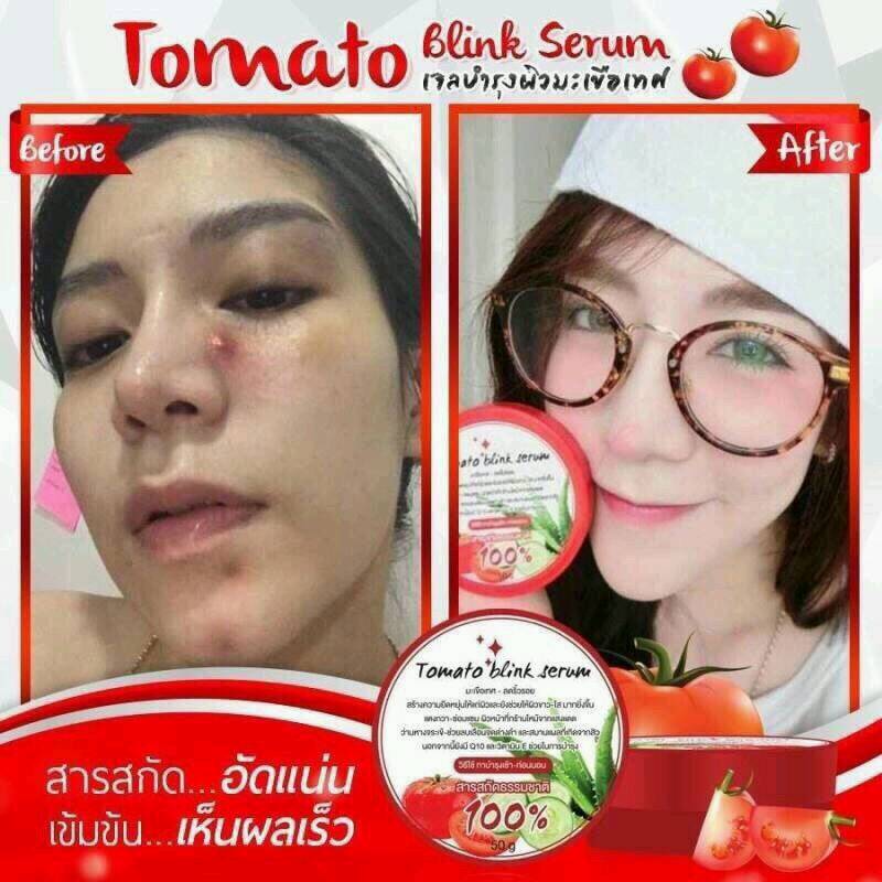 เซรั่มมะเขือเทศTomato blink serum (โทเมโท บริ้ง เซรั่ม)