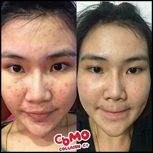 โคโม๊ะ คอลลาเจน ซีพลัส Como Collagen C+