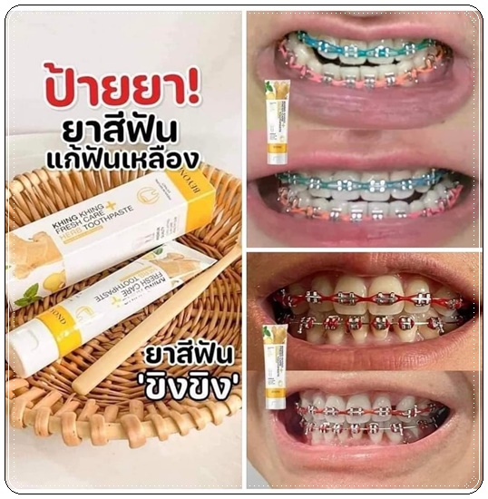 ยาสีฟันขิงขิง Khing Khing Fresh Care Herb Toothpaste ยาสีฟันบียอน (1แถม1)