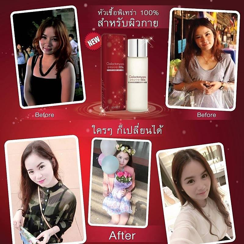 หัวเชื้อพิเทร่าตัวขาว (Secret Galactomyces white body serum)