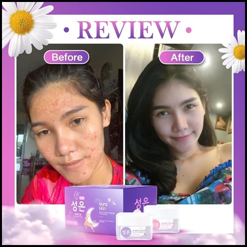 ออร่าสกิน เดย์ & ไนท์ ครีม Aura Skin Day & Night Cream by Thida (ส่งฟรี)