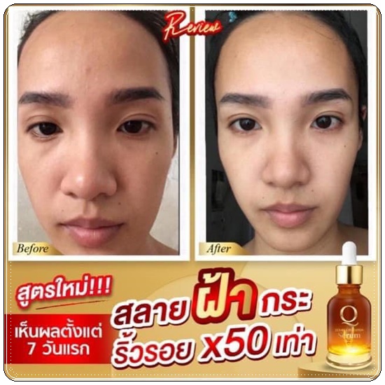 คิวดับเบิ้ลบูธเตอร์เซรั่ม Q Double Booster Serum (ส่งฟรี)