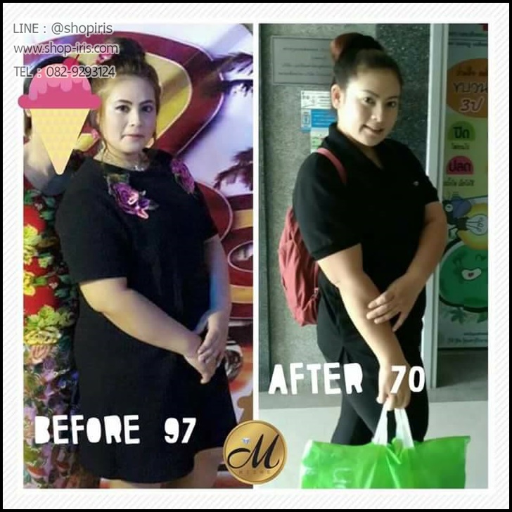 MIZME มิซมี บายเซฟลี่พิ้ง เมริซ่า อาหารเสริมลดน้ำหนัก