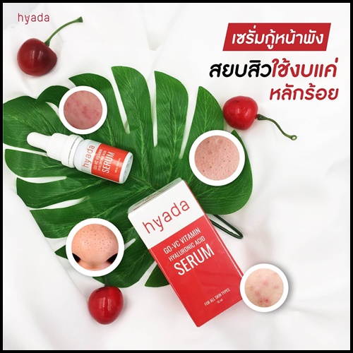 เซรั่มไฮยาดา Hyada Go-VC Vitamin Hyaluronic Acid Serum (1 แถม 1)