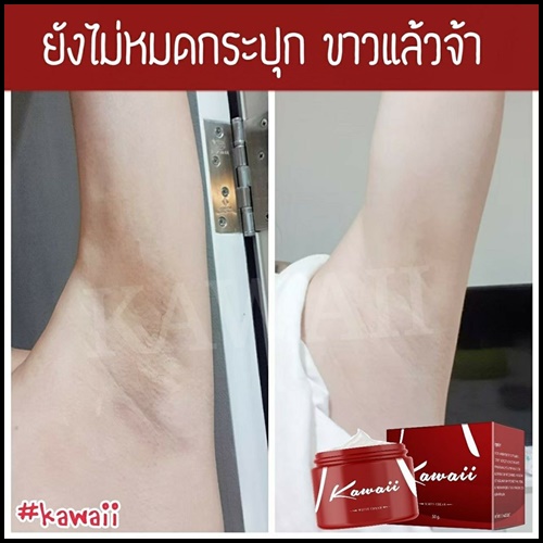 Kawaii ครีมรักแร้ขาว คาวาอี้