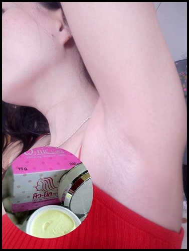 คิวนิคแคร์ ครีมทารักแร้ขาว Q-nic Care