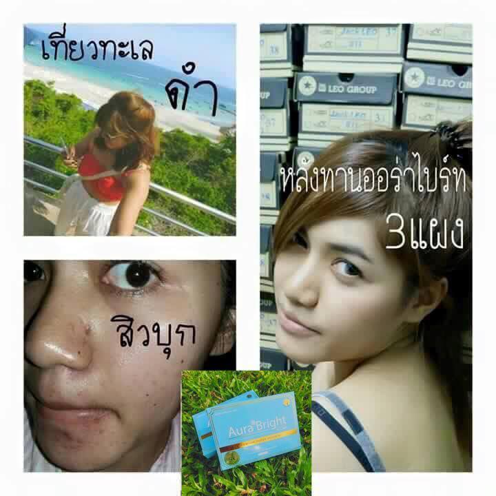 ออร่าไบรท์ ออลิน่า กล่องฟ้า (Aurabright Allina L-Glutathione & Co-Q10) โฉมใหม่