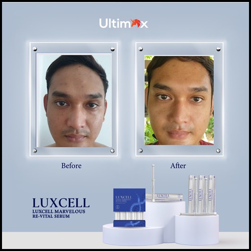 เซรั่มหน้าเด็ก Luxcell คุณภาพระดับสเต็มเซลล์ ของแท้