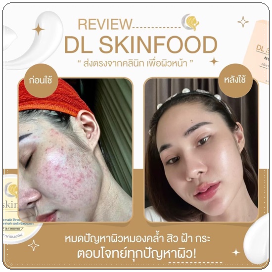 Deli Skin Night Cream ไนท์ครีมบำรุงผิวหน้า