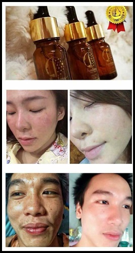 เซรั่มสลายฝ้า Kemtong skin care