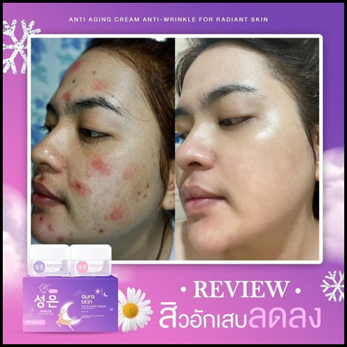 ออร่าสกิน เดย์ & ไนท์ ครีม Aura Skin Day & Night Cream by Thida (ส่งฟรี)