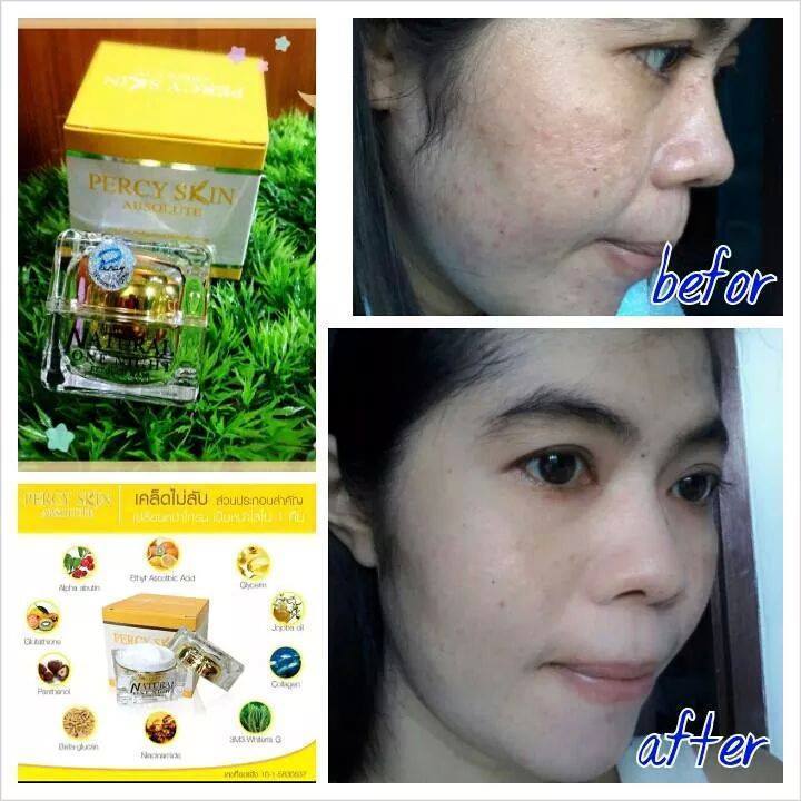 เพอร์ซี่สกิน มาส์ก (Percy Skin Absolute Mask)