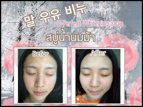 สบู่น้ำนมม้า ดี เพอร์เฟค ไวท์เทนนิ่ง โซป D-Perfect Whitening Soap