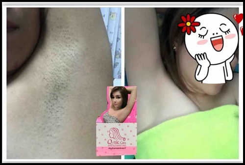 คิวนิคแคร์ ครีมทารักแร้ขาว Q-nic Care