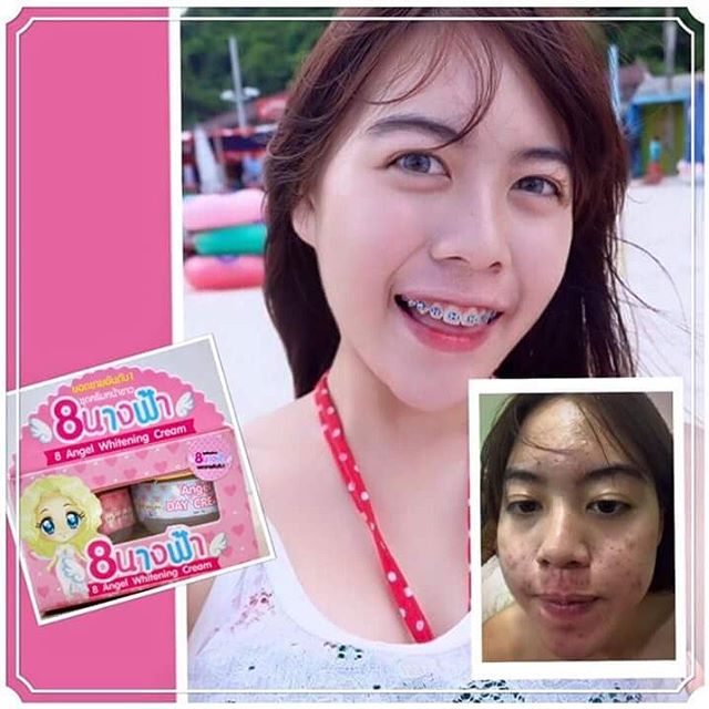 ชุดครีมหน้าใส 8นางฟ้า (8 Angel Whitening Cream)