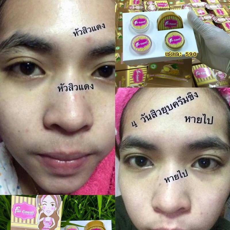 ครีมขิงหน้าสด by Faii cawaii