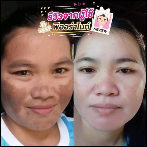 พีออร่าไนท์ ไวท์เทนนิ่ง P Aura Night Whitening แพคเกตใหม่ ของแท้