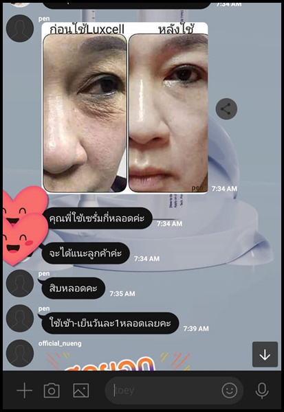 เซรั่มหน้าเด็ก Luxcell คุณภาพระดับสเต็มเซลล์ ของแท้
