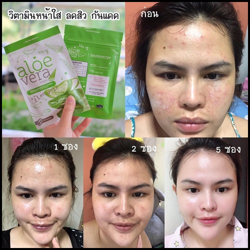 ว่านหางจระเข้สกัดเย็น Aloe Vera Softgels อโลเวร่าชนิดเม็ด