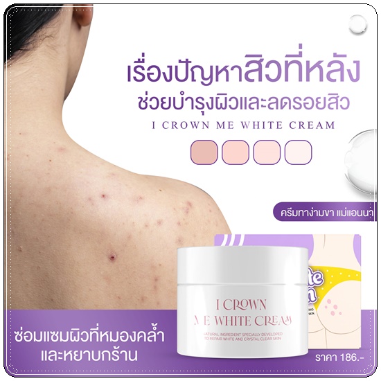 ครีมง่ามขาแอนนา Me White Cream By I CROWN