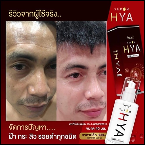 อิงฟ้า เซรั่ม ไฮยา พลัส INGFA Serum HYA PLUS