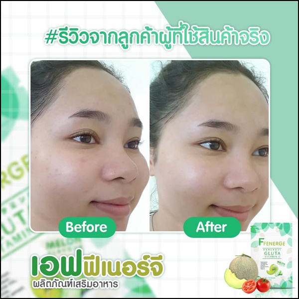 เอฟฟีเนอร์จี กลูต้า FFenerge Gluta Vitamin C กลูต้าเมล่อน (ส่งฟรี)