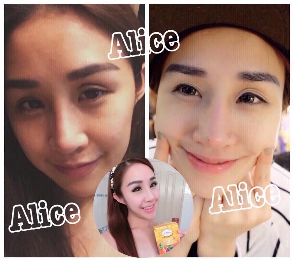 เซรั่มสับปะรด&องุ่น (เซรั่มเทพหน้าใส Pineapple & Grape Seed Serum)