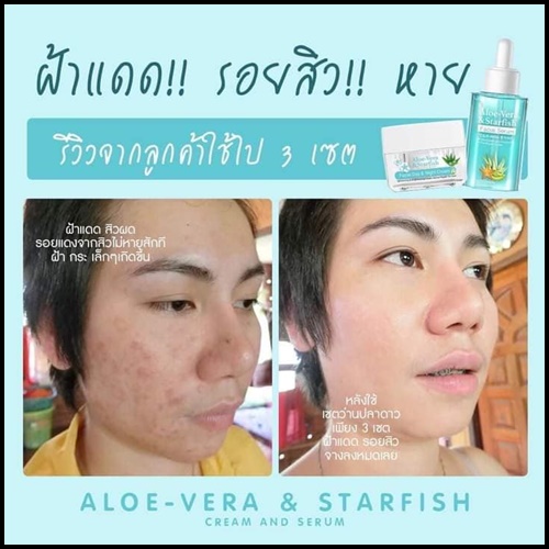 เซตว่านปลาดาว กู้ผิวเสีย Aloe-Vera & Starfish (1 แถม 1)