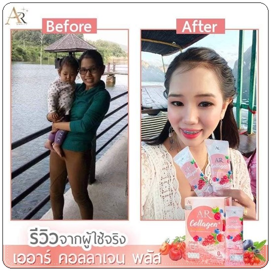 เออาร์ คอลลาเจน พลัส AR Collagen+
