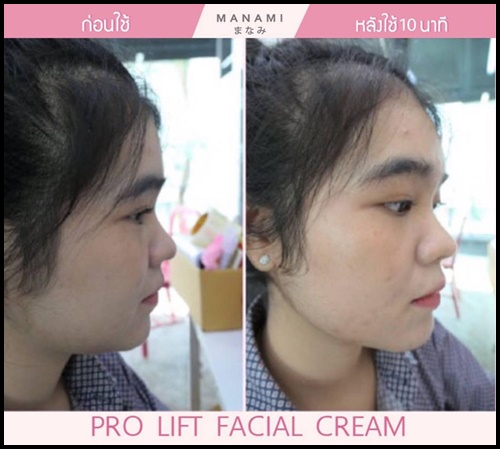 Manami Pro Lift Facial Cream ครีมหน้าเรียว ยกกระชับผิว