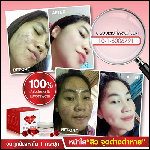 รับบี้ โรส ครีม Ruby Roses Cream ครีมรากหญ้า