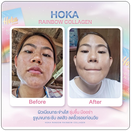 คอลลาเจนสายรุ้ง HOKA Random Rainbow Collagen คอลลาเจน 7 สี (1แถม1 ส่งฟรี)