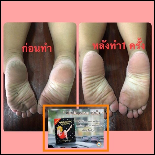 สปาเท้าคุณนาย สูตรใหม่