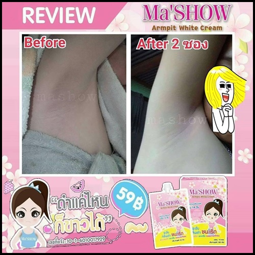 มาโชว์ ครีมทารักแร้ขาว Ma'SHOW