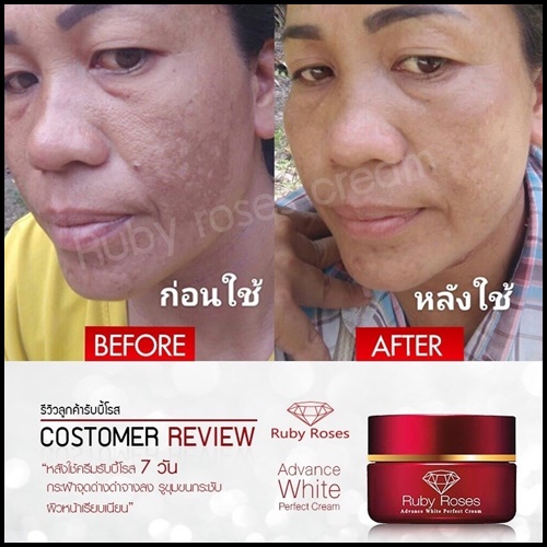 รับบี้ โรส ครีม Ruby Roses Cream ครีมรากหญ้า