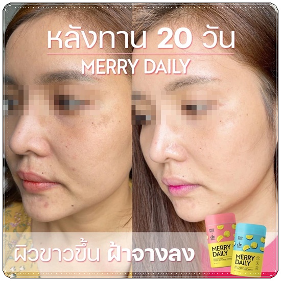 Merry Daily วิตามินเร่งขาวลดเครียด (ของแท้)