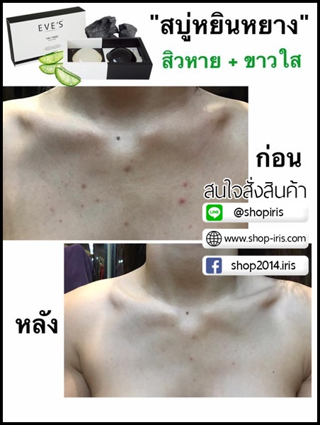 สบู่หยินหยาง Yin Yang Duo Soap By EVE's